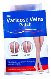 Parches para varices